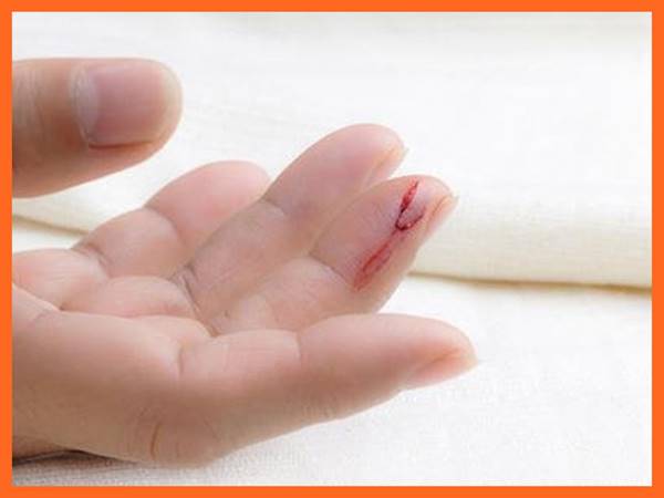 Mơ thấy đứt tay là điềm báo hung hay cát? Đánh con gì